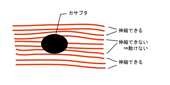 伸縮できない筋線維