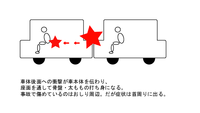 追突事故の衝撃の伝わり方